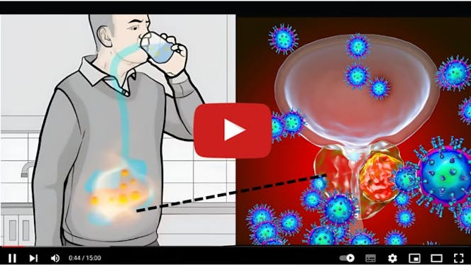 01cc5f98-dd88-11ef-a07e-06d664cfaed9%2F5523848e488b9da2fb0e879dcb8d0fedccf49ab9%2Fprostate.jpg?auto=compress,format&fit=scale&w=664&h=374