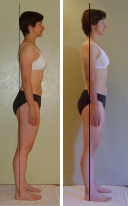 Before and after 10 sessions, side view with plumb line