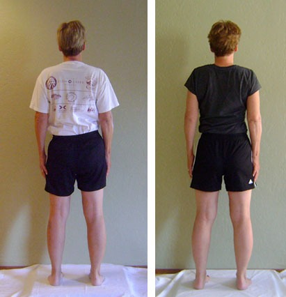 Before and after 10 sessions, back view