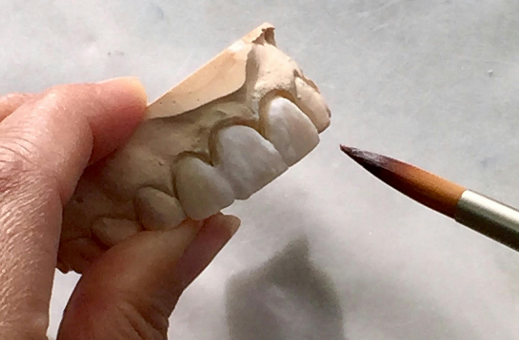 Advanced Ceramics Dental Laboratory Christchurch